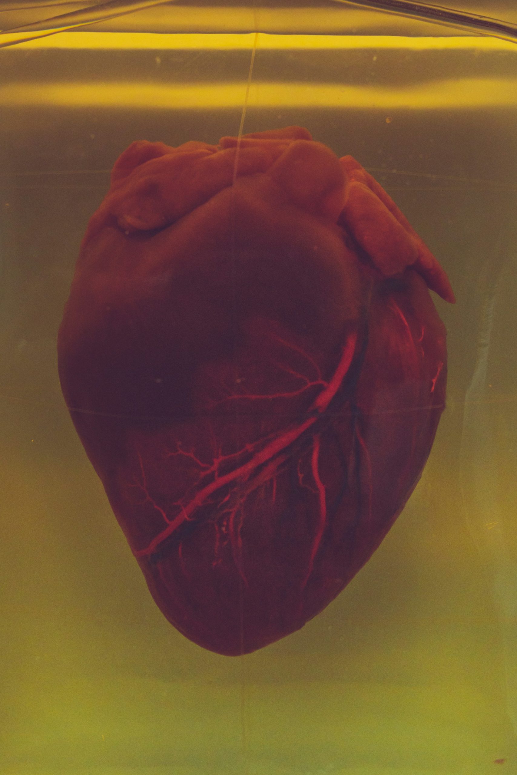 Researchers have created hyper-realistic models of diseased hearts to help train transplant surgeons